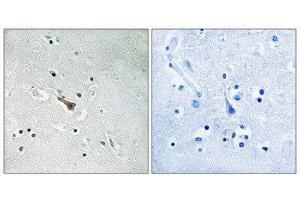 Immunohistochemistry (IHC) image for anti-Amyloid beta (A4) Precursor-Like Protein 2 (APLP2) (pTyr755) antibody (ABIN1847734)