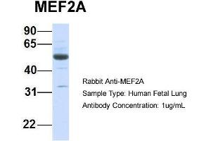 Host:  Rabbit  Target Name:  MEF2A  Sample Type:  Human Fetal Lung  Antibody Dilution:  1. (MEF2A antibody  (Middle Region))