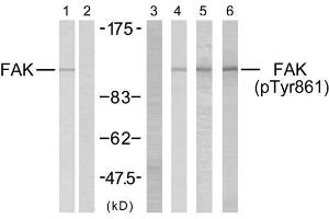 Western blot analysis using FAK (Ab-861) antibody (E021076, Lane 1 and 2) and FAK (phospho-Tyr861) antibody (E011059, Lane 3, 4, 5 and 6). (FAK antibody)