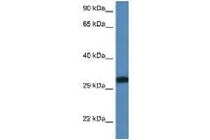 Image no. 1 for anti-Distal-Less Homeobox 6 (DLX6) (C-Term) antibody (ABIN6747317) (DLX6 antibody  (C-Term))