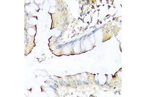 Immunohistochemistry of paraffin-embedded human colon using NRG4 antibody (ABIN1873958) at dilution of 1:100 (40x lens). (Neuregulin 4 antibody)