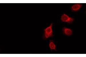 ABIN6276057 staining HeLa by IF/ICC. (GPROPDR antibody)
