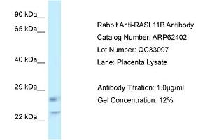 Western Blotting (WB) image for anti-RAS-Like, Family 11, Member B (RASL11B) (C-Term) antibody (ABIN2789132)