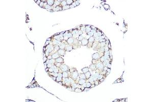 Immunohistochemistry of paraffin-embedded rat testis using SSTR5 Rabbit mAb (ABIN7270495) at dilution of 1:100 (40x lens). (SSTR5 antibody)
