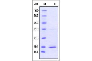 Human TNF-alpha, His Tag on SDS-PAGE under reducing (R) condition. (TNF alpha Protein (AA 77-233) (His tag))