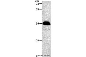 Western blot analysis of Jurkat cell, using PPP2CB Polyclonal Antibody at dilution of 1:1200 (PPP2CB antibody)