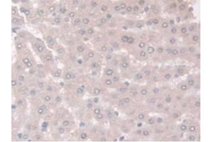 IHC-P analysis of Rat Liver Tissue, with DAB staining. (Adiponectin Receptor 2 antibody  (AA 1-147))