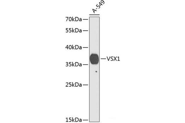 VSX1 抗体