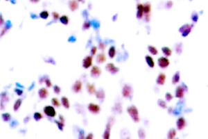 Image no. 2 for anti-Collagen, Type XVIII, alpha 1 (COL18A1) (Chain alpha 1) antibody (ABIN265401) (COL18A1 antibody  (Chain alpha 1))