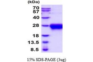 SDS-PAGE (SDS) image for Activin A Receptor, Type IIA (ACVR2A) (AA 20-135) protein (His tag) (ABIN5854601) (ACVR2A Protein (AA 20-135) (His tag))