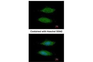 ICC/IF Image Immunofluorescence analysis of methanol-fixed HeLa, using LOC283129, antibody at 1:200 dilution. (C11orf85 antibody  (Center))