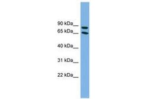 Image no. 1 for anti-Disabled Homolog 1 (Drosophila) (DAB1) (C-Term) antibody (ABIN6743635)