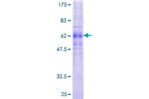 PRLHR Protein (AA 1-370) (GST tag)