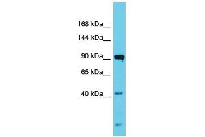Host:  Rabbit  Target Name:  Nlgn3  Sample Type:  Rat Testis lysates  Antibody Dilution:  1. (Neuroligin 3 antibody  (N-Term))