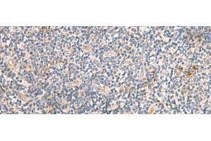 Immunohistochemistry of paraffin-embedded Human tonsil tissue using MEST Polyclonal Antibody at dilution of 1:50(x200)