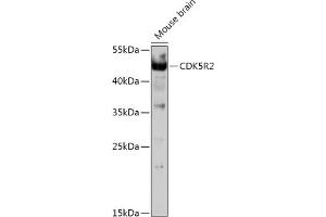 Western blot analysis of extracts of Mouse brain, using CDK5R2 antibody (ABIN7266593) at 1:1000 dilution.