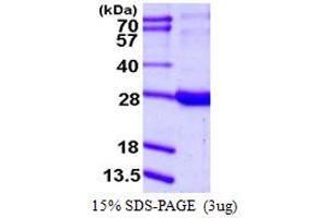 Retinol Binding Protein 1, Cellular (RBP1) (AA 1-197) protein (His tag)