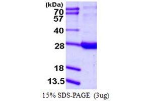 SDS-PAGE (SDS) image for Retinol Binding Protein 1, Cellular (RBP1) (AA 1-197) protein (His tag) (ABIN7279628) (RBP1 Protein (AA 1-197) (His tag))