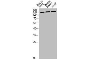 Western blot analysis of mouse-lung mouse-heart 293T lysis using CEP135 antibody. (CEP135 antibody  (C-Term))