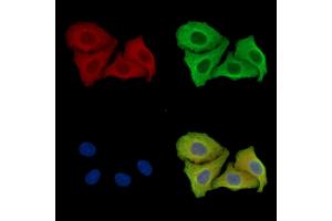 ABIN7097003 and ABIN7101070 staining Hela cells by IF/ICC.