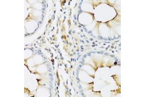 Immunohistochemistry of paraffin-embedded human colon using RN antibody (ABIN3015630, ABIN3015631, ABIN3015632 and ABIN6218985) at dilution of 1:100 (40x lens). (RNASE3 antibody  (AA 28-160))