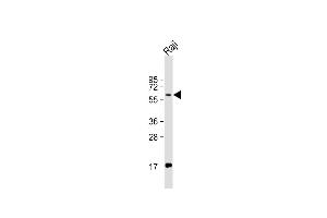 Anti-RIPK2 Antibody  at 1:1000 dilution + Raji whole cell lysate Lysates/proteins at 20 μg per lane. (RIPK2 antibody  (C-Term))