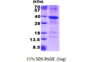 Image no. 1 for CD46 (CD46) protein (His tag) (ABIN1098582) (CD46 Protein (CD46) (His tag))