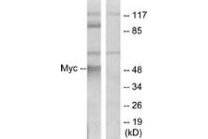 Western blot analysis of extracts from ovary cancer cells, using MYC (Ab-58) Antibody. (c-MYC antibody  (AA 25-74))