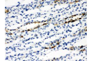 Anti-SLC9A2 antibody, IHC(P) IHC(P): Rat Kidney Tissue