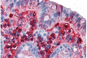 Human Colon (formalin-fixed, paraffin-embedded) stained with IgA antibody ABIN337297 at 10 ug/ml followed by biotinylated anti-mouse IgG secondary antibody ABIN481714, alkaline phosphatase-streptavidin and chromogen. (Mouse anti-Human IgA Antibody)