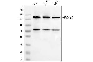 Western blot analysis of RGS12 using anti-RGS12 antibody (ABIN7602410).