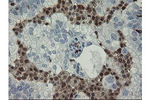 Image no. 2 for anti-GTPase, IMAP Family Member 4 (GIMAP4) antibody (ABIN1498460) (GIMAP4 antibody)