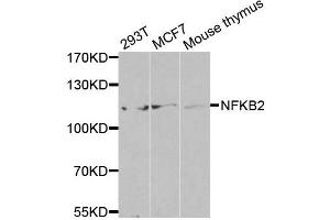 Western Blotting (WB) image for anti-Nuclear Factor of kappa Light Polypeptide Gene Enhancer in B-Cells 2 (NFKB2) (AA 690-899) antibody (ABIN3017388)