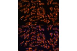 Immunofluorescence analysis of U-2 OS cells using PRX antibody (ABIN7269215) at dilution of 1:100. (Periaxin antibody  (AA 1250-1350))