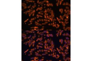 Immunofluorescence analysis of U-2 OS cells using PRX antibody (ABIN7269215) at dilution of 1:100. (Periaxin antibody  (AA 1250-1350))