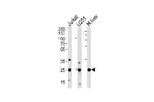 Western blot analysis of lysates from Jurkat, U251 cell line and human liver tissue (from left to right), using GSTM1 Antibody at 1:1000 at each lane. (GSTM1 antibody  (C-Term))