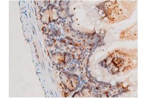 ABIN6267524 at 1/200 staining Mouse intestinal tissue sections by IHC-P.