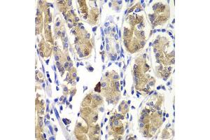 Immunohistochemistry of paraffin-embedded human stomach using SHC1 antibody (ABIN5995412) at dilution of 1/100 (40x lens).