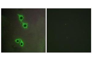 Immunofluorescence analysis of COS-7 cells, using MAST4 antibody. (MAST4 antibody  (N-Term))