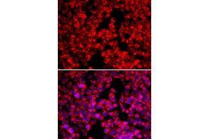 Immunofluorescence analysis of U20S cell using MTTP antibody. (MTTP antibody  (AA 1-130))