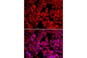 Immunofluorescence analysis of U20S cell using MTTP antibody. (MTTP antibody  (AA 1-130))