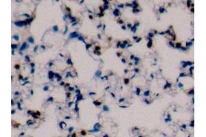 Immunohistochemistry (IHC) image for anti-Protein tyrosine Phosphatase, Receptor Type, C (PTPRC) (AA 371-556) antibody (ABIN7437023)