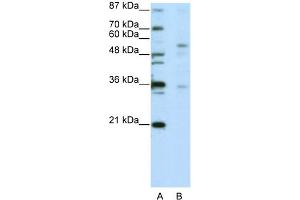 WB Suggested Anti-ZNF57 Antibody Titration:  5.