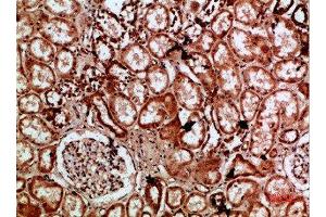 Immunohistochemical analysis of paraffin-embedded human-kidney, antibody was diluted at 1:200 (IMP3 antibody  (AA 135-184))