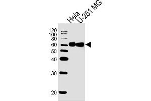 Lane 1: HeLa Cell lysates, Lane 2: U-251 MG Cell lysates, probed with FUBP3 (1216CT820. (FUBP3 antibody)