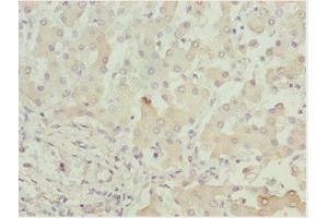 Immunohistochemistry of paraffin-embedded human liver tissue using ABIN7143434 at dilution of 1:100