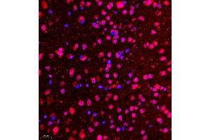 CDY1 antibody