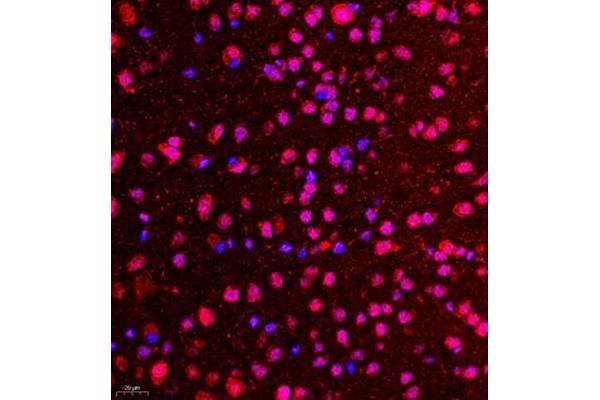 CDY1 antibody