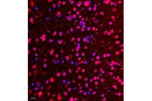 Immunofluorescence of paraffin embedded mouse brain using CDY1 (ABIN7073493) at dilution of 1:400 (400x lens) (CDY1 antibody)