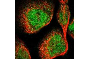 Immunofluorescent staining of A-431 cells using DGKE polyclonal antibody  shows positivity in cytoplasm and nucleus (green) but excluded from the nucleoli. (DGKE antibody  (AA 63-192))